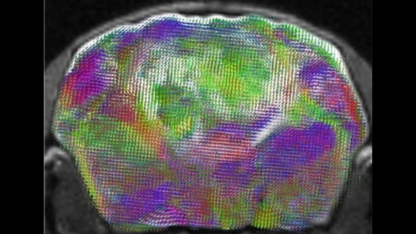 Ressonância magnética do cérebro de um dos camundongos com córtex humano do estudo de Stanford, com o mapa das fibras nervosas em cores