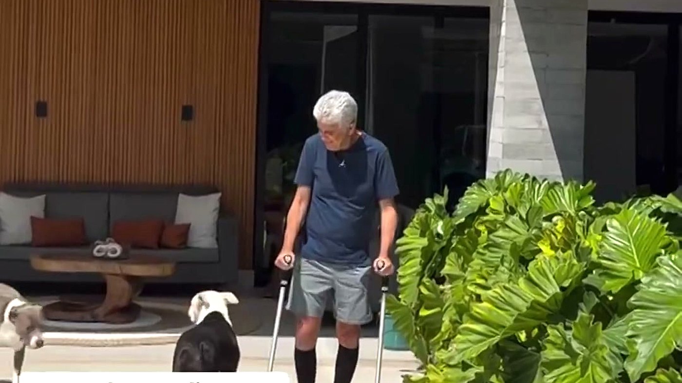 Bebeto caminha apoiado em duas muletas no quintal de casa em vídeo publicado nos Stories do Instagram