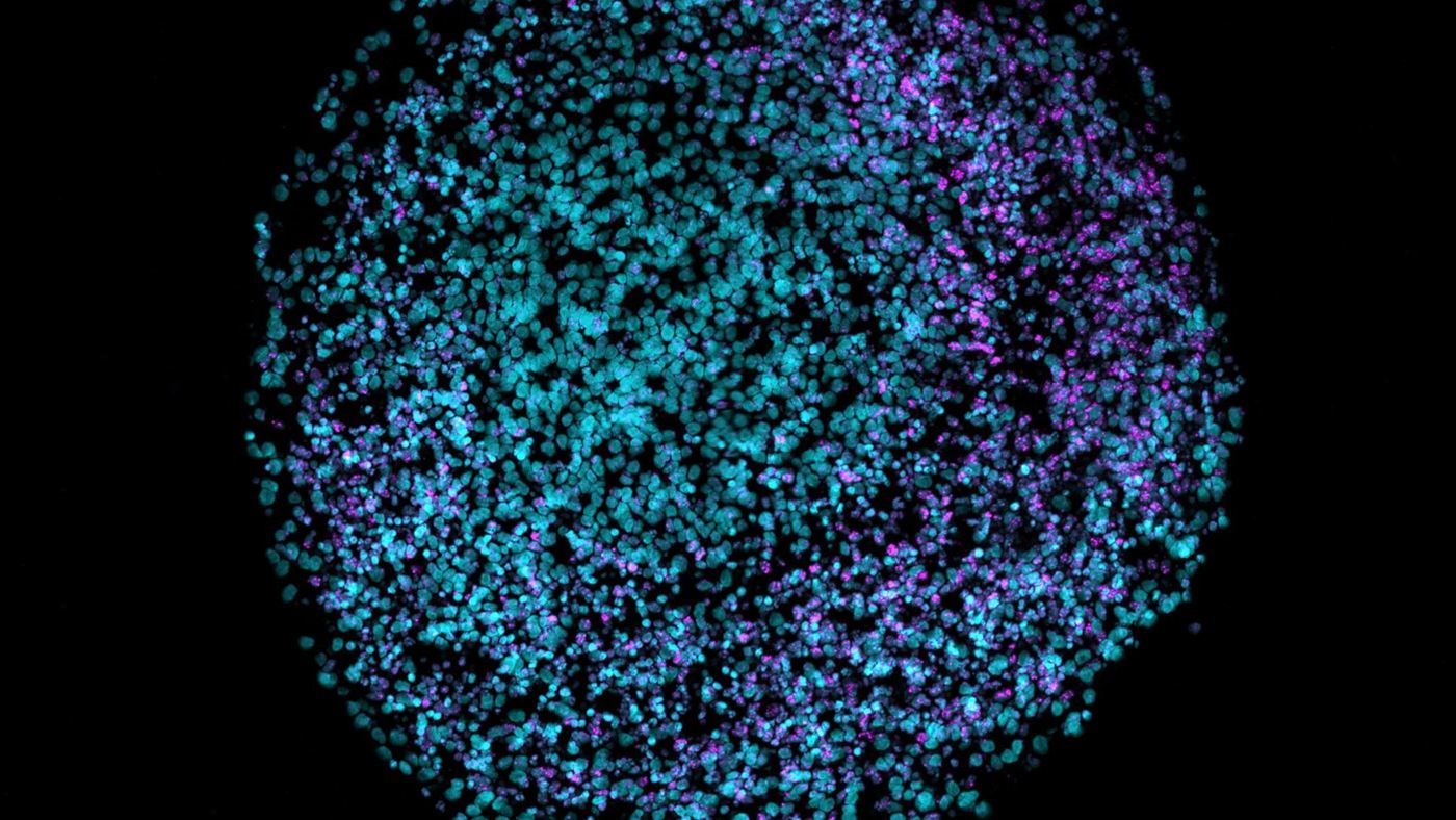 Organoide de córtex humano cultivado em laboratório, semelhante ao implantado em camundongos com cérebro humano