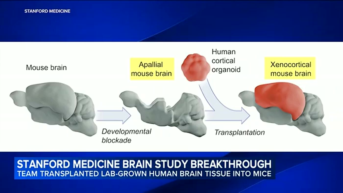 Diagrama do estudo de Stanford mostrando o cérebro do camundongo apalial recebendo o organoide de córtex humano até virar o cérebro xenocortical
