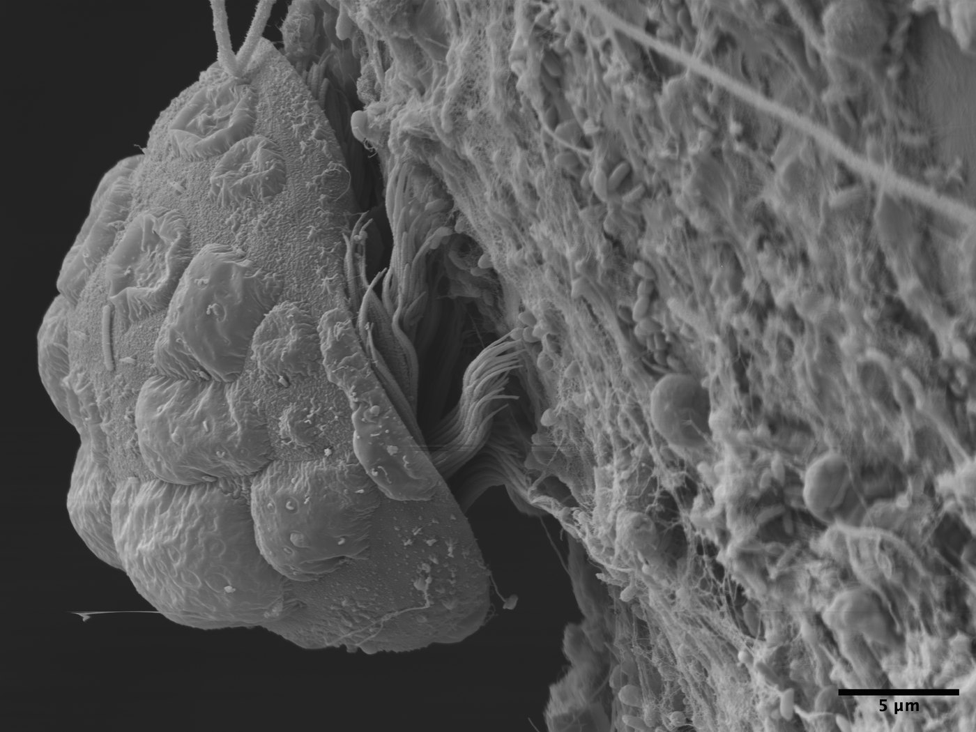 Imagem de microscópio de um parasita minúsculo preso à superfície do corpo da aranha-do-mar